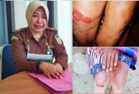 Humas Kejari Kendari, Iswati membenarkan berkas pelaku penganiayaan terhadap Wa Rimpu sudah masuk di Kejari Kendari namun tidak lengkap dari penyidik Polsek Mandonga. (*Ist). 
