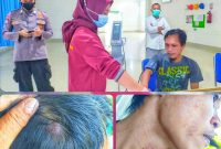 Ruslan menjalani perawatan usai dianiaya Oknum RT di Andoolo, Konawe Selatan. Jum'at (20/05/2022). (*Ist) 