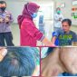 Ruslan menjalani perawatan usai dianiaya Oknum RT di Andoolo, Konawe Selatan. Jum'at (20/05/2022). (*Ist) 